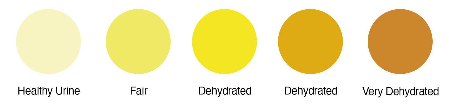 Preventing Dehydration - Urine Chart